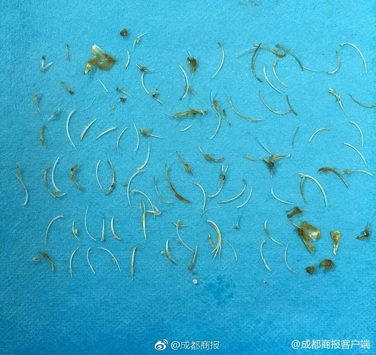 【吃瓜fun】是2023年陳述病例數(shù)的兩倍